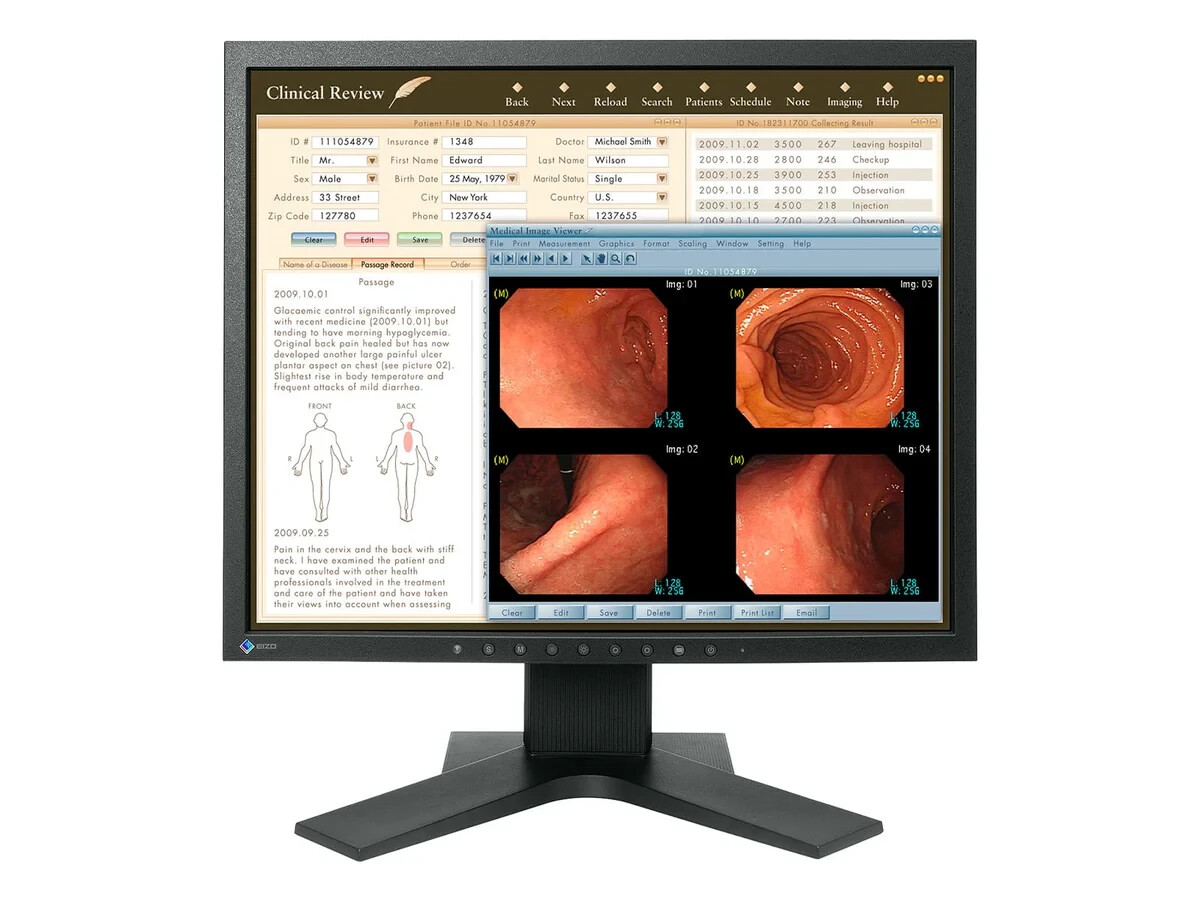 Eizo RadiForce MX192 1MP 19″ Color LCD Clinical Review Monitor ,1 left