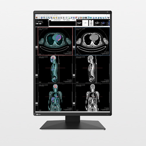 EIZO RadiForce RX370